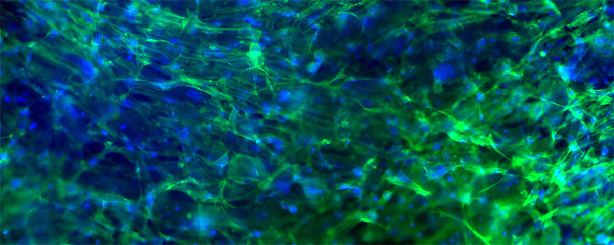 Spreading of the cells in the printed object